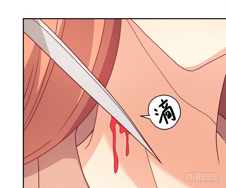 170话 被抓住了！7