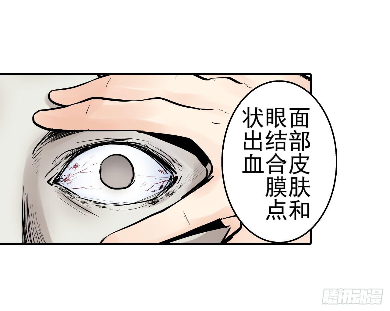 案件开始19