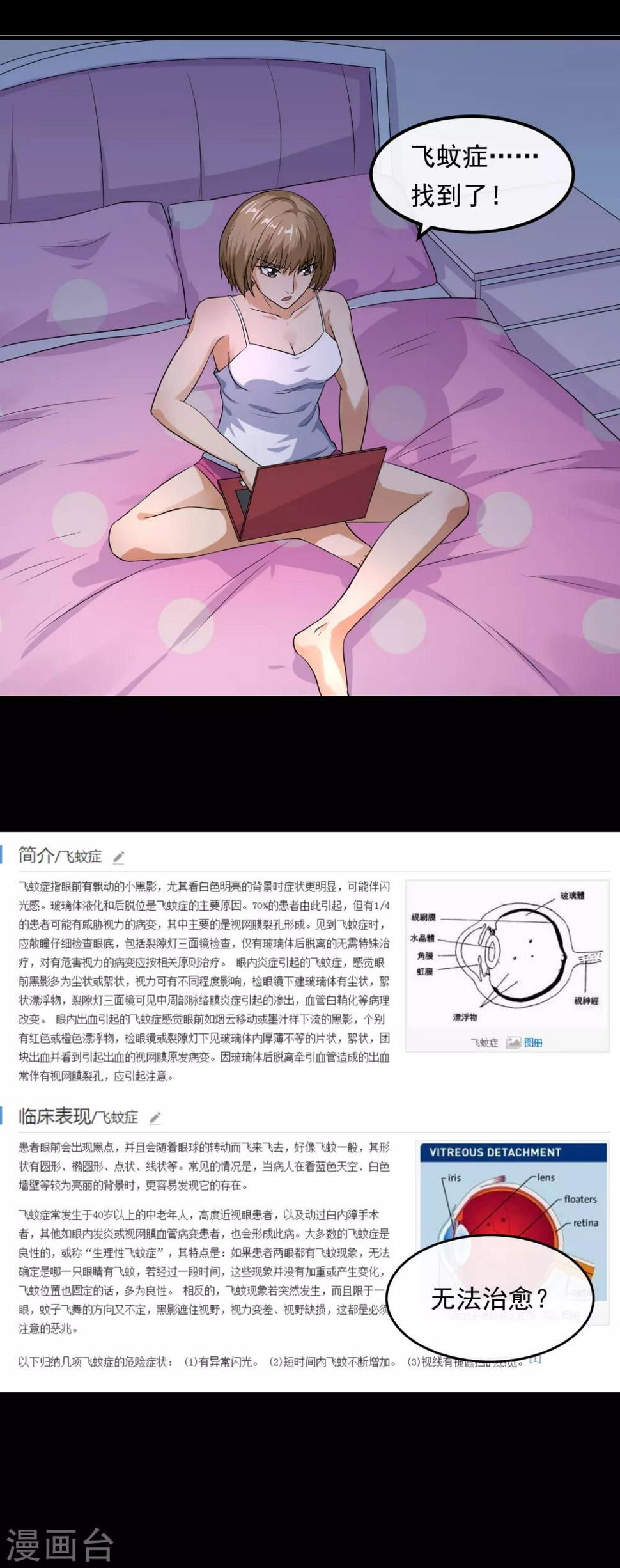 第19话 飞蚊症29