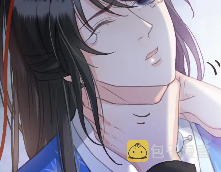 第72话 命悬一线117