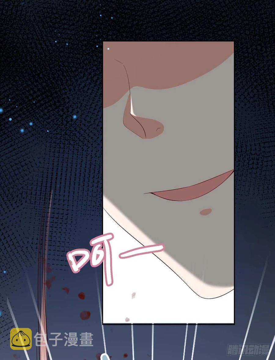 第49话 毁容29