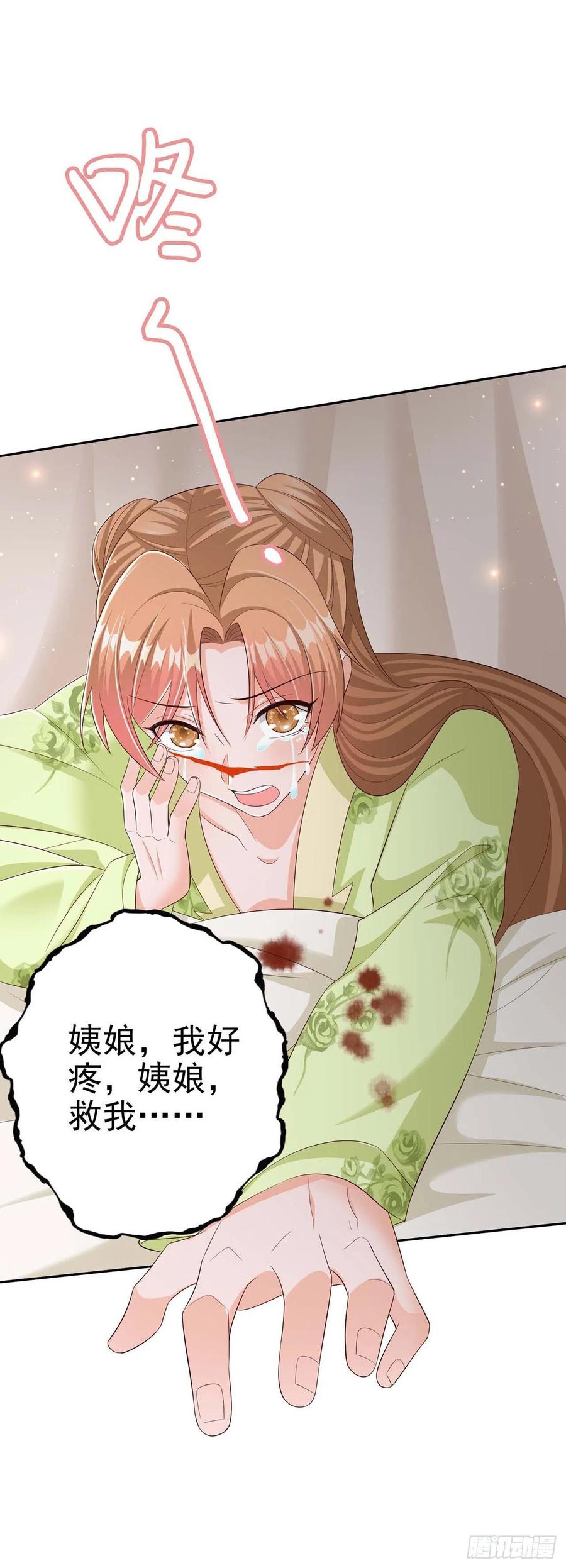 第49话 毁容33