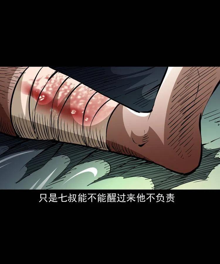 一百四十七话 吸血蚂蟥64