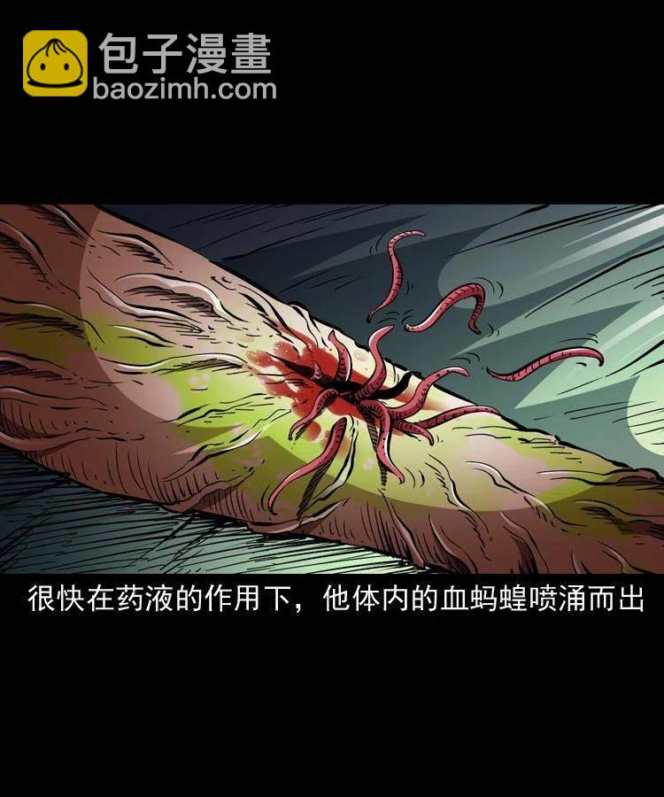 一百四十七话 吸血蚂蟥59