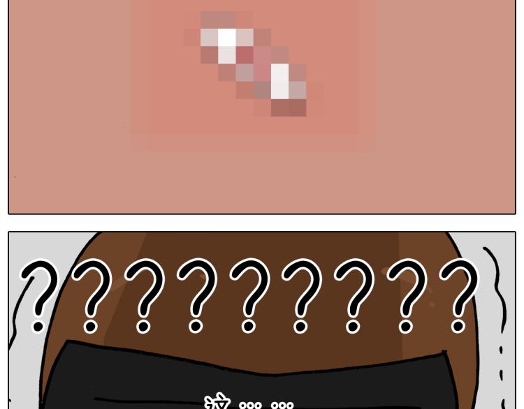 第361话 火疖子47