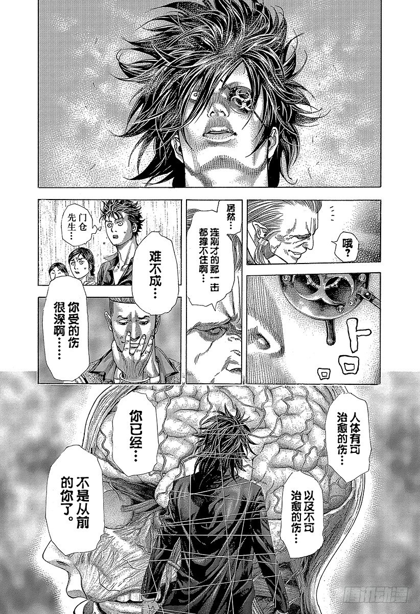第364话 互相击打7