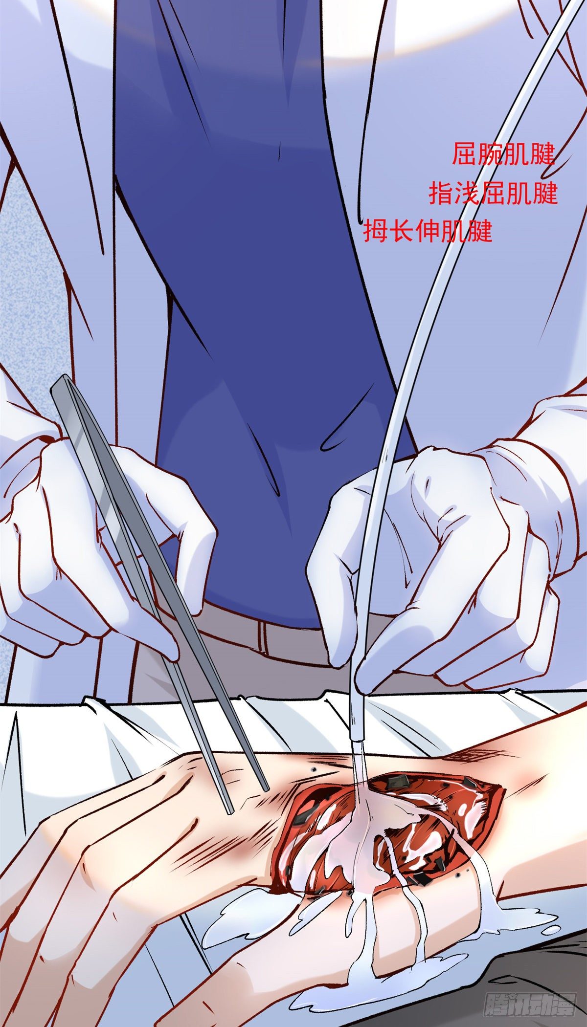 04 肌腱缝合手术82