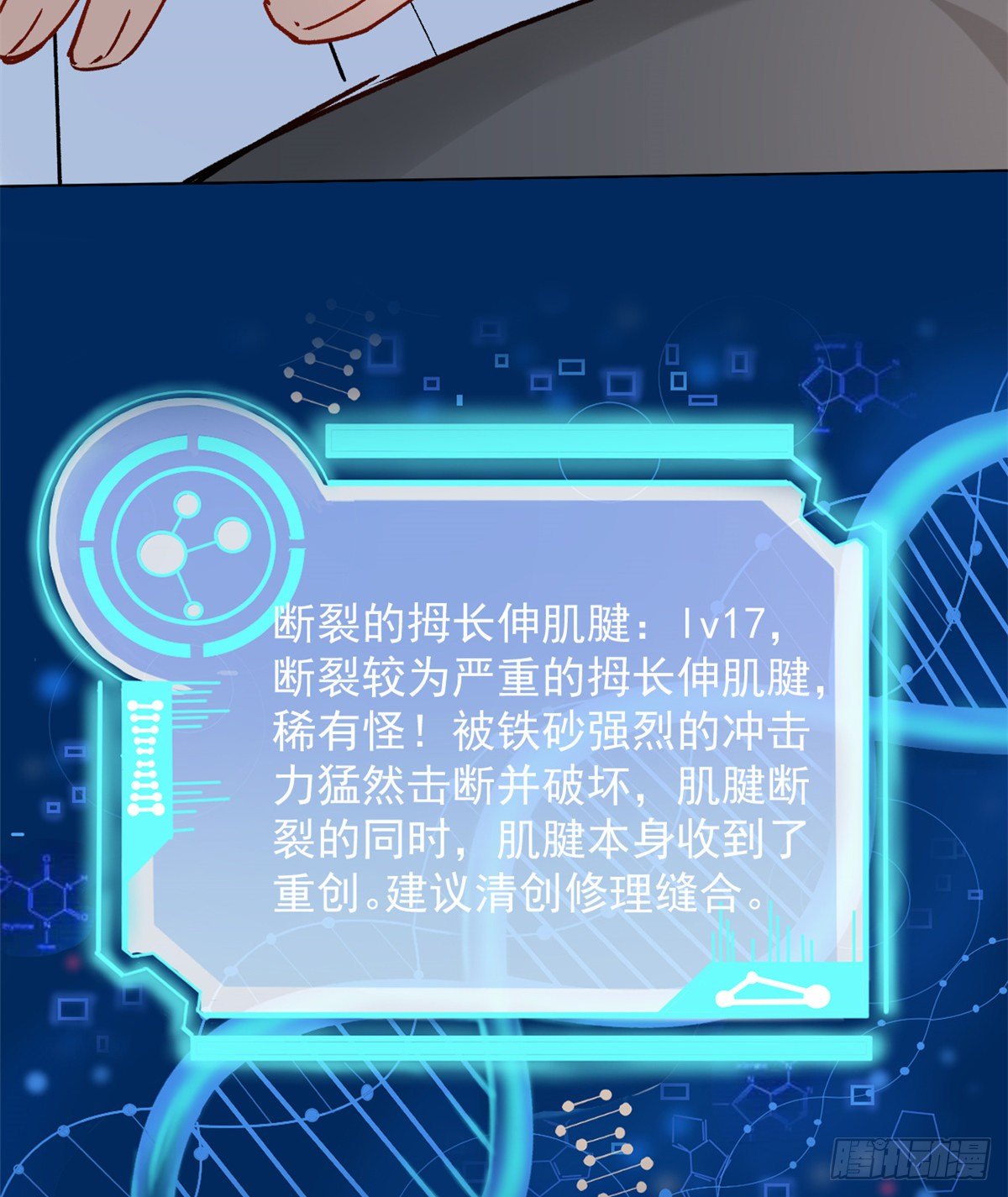 04 肌腱缝合手术83