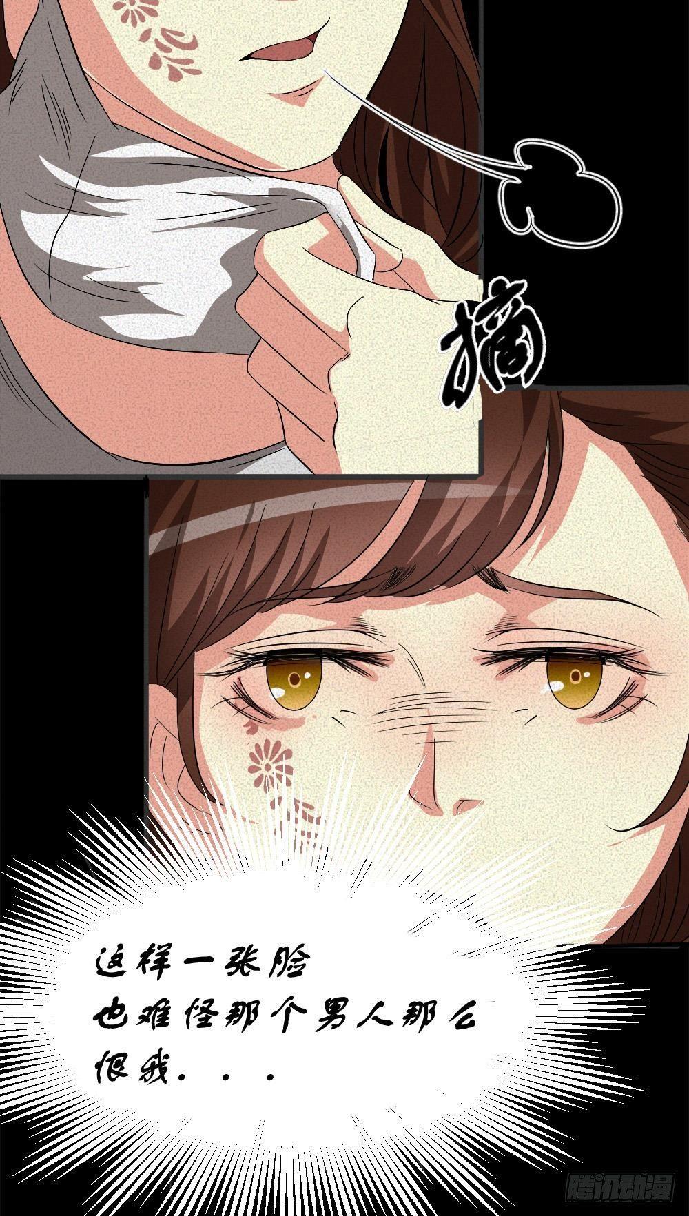 第五话 胎记能自愈21