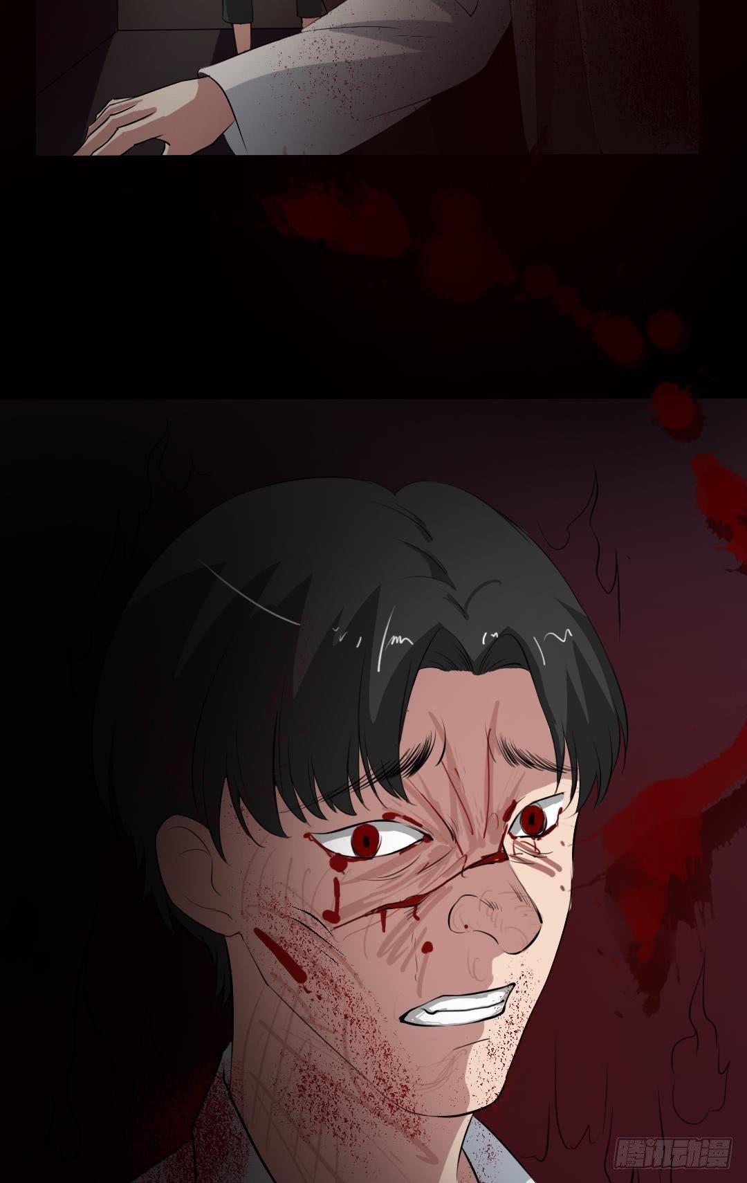 第16话 手术台上17