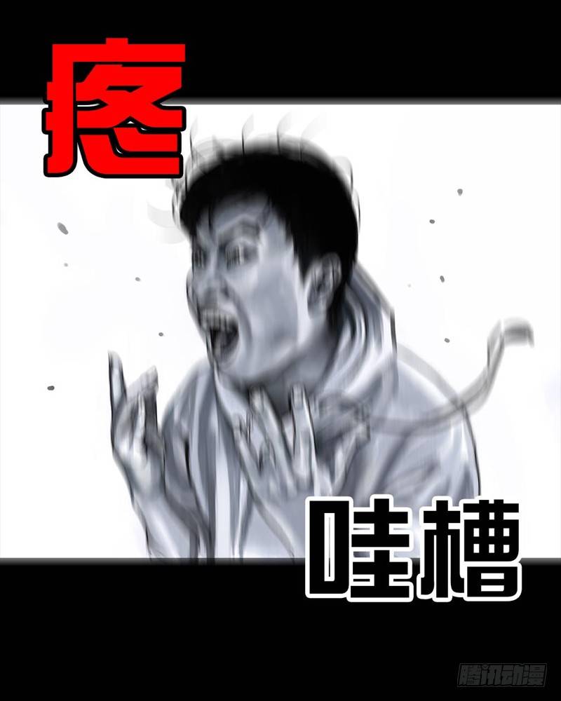 番外：拔牙34