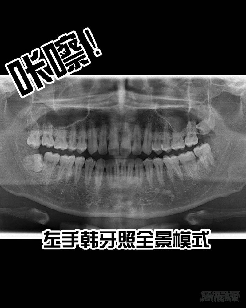 番外：拔牙17