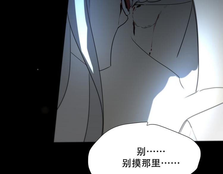 第14话  痛！31