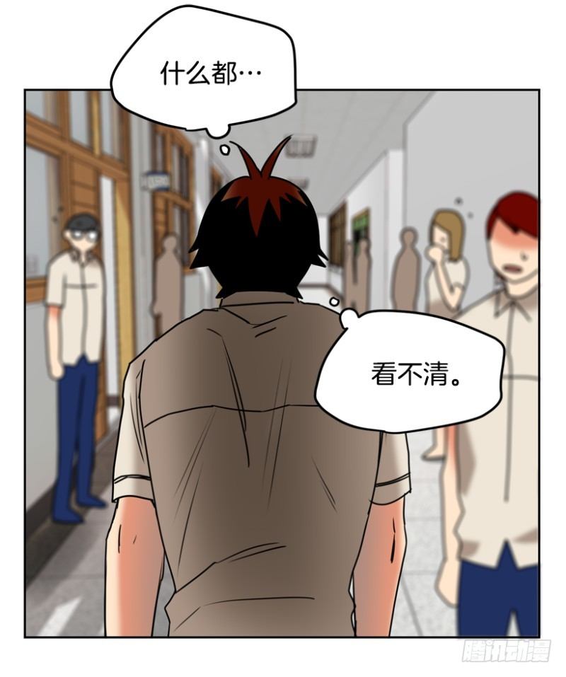 高度近视14
