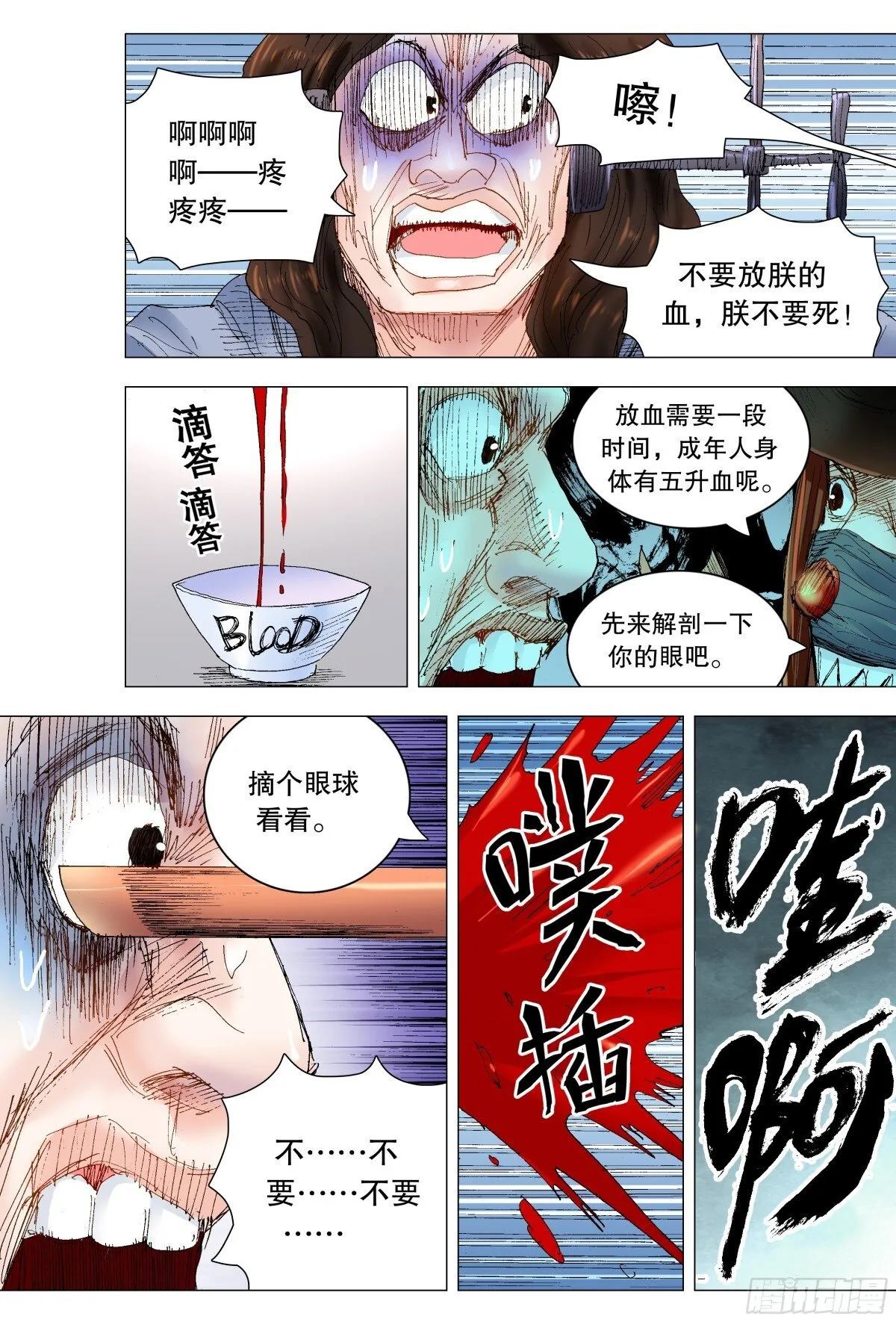 243 精神病患者9