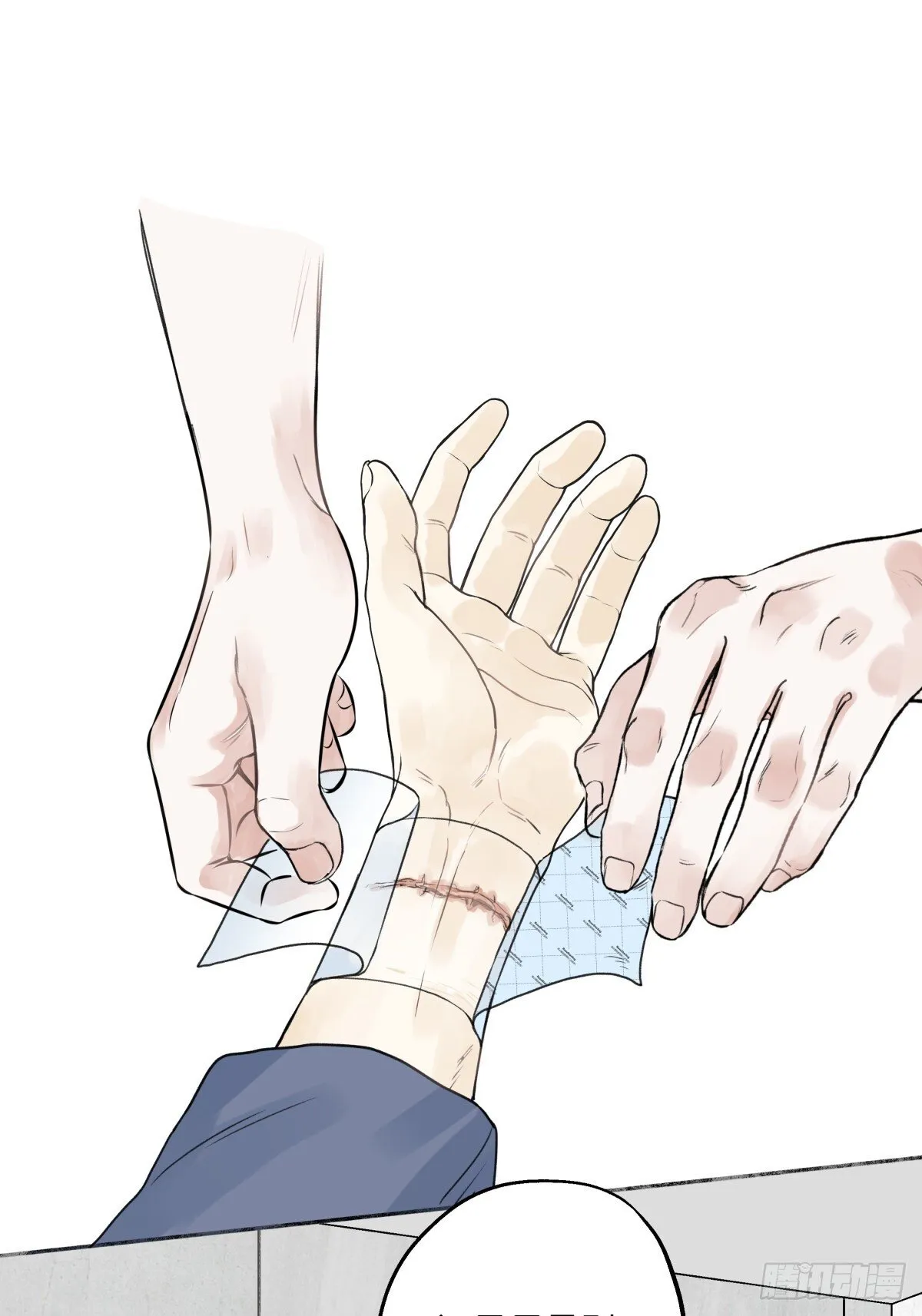 79 疤痕8