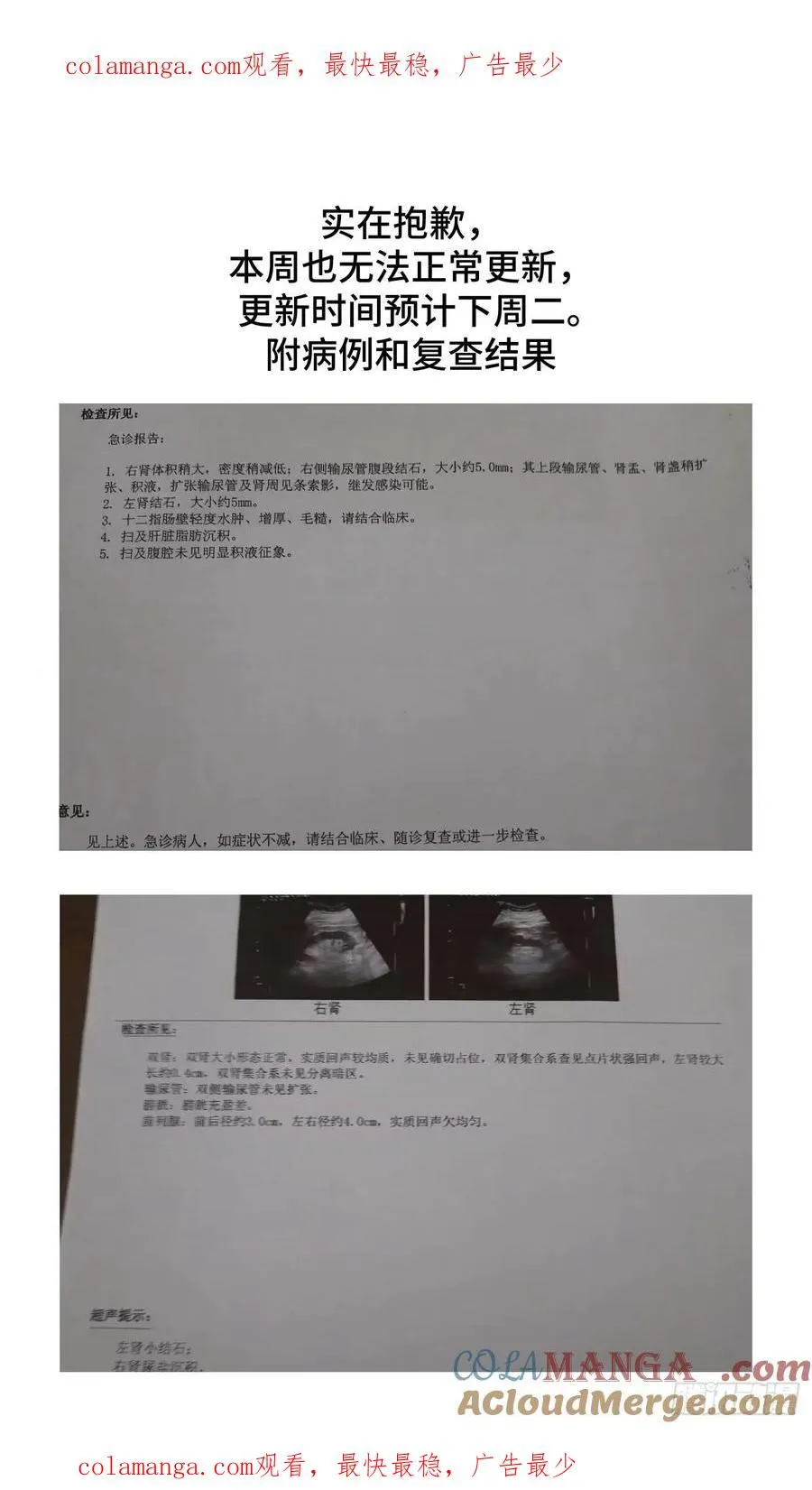 抱歉，本周更新也要延迟0
