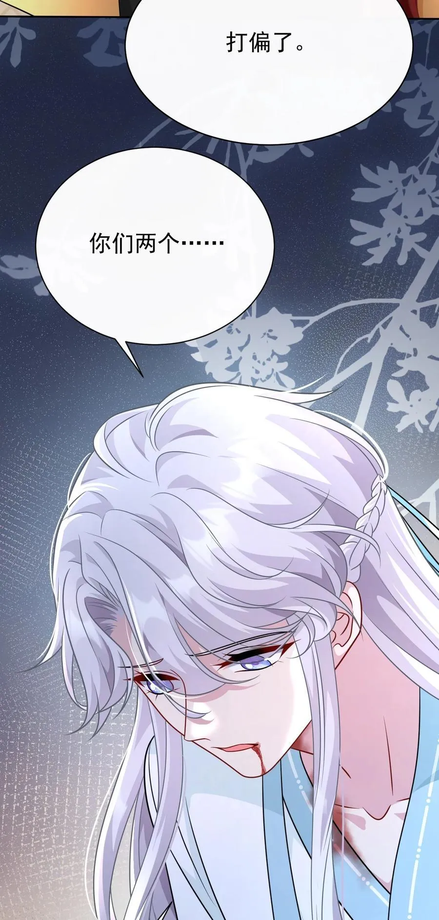 012 手不想要了？29