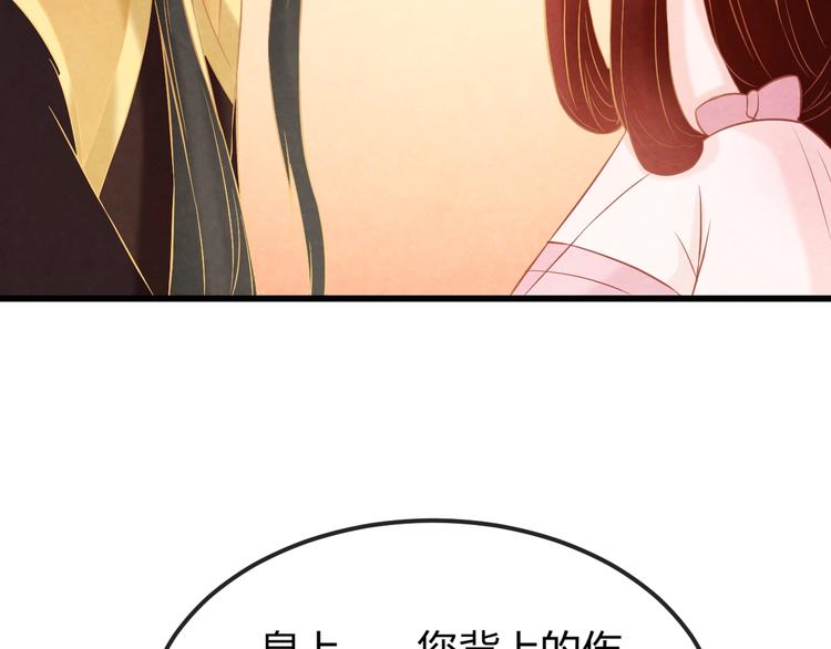 第29话 亲自为你上药64