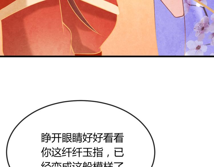 第33话 营救111