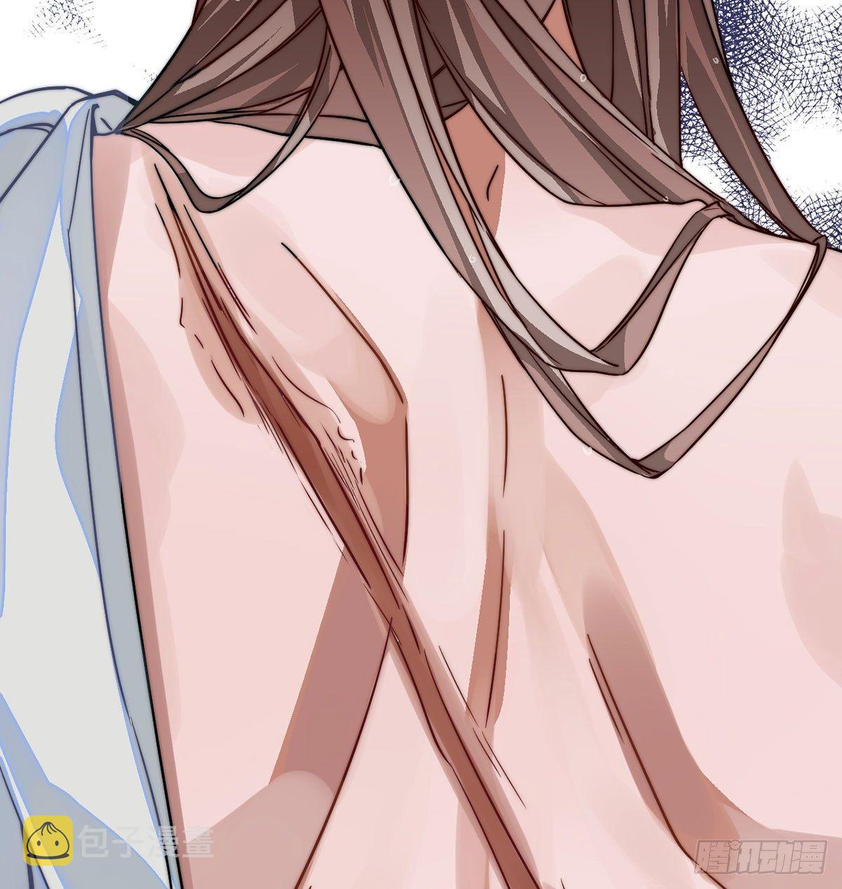 03.隐藏起来的伤痕92
