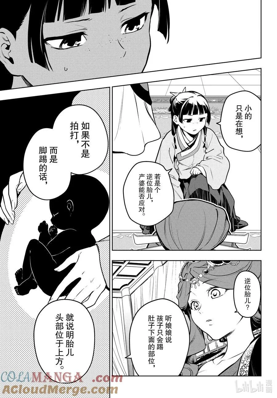 69 逆位胎儿4