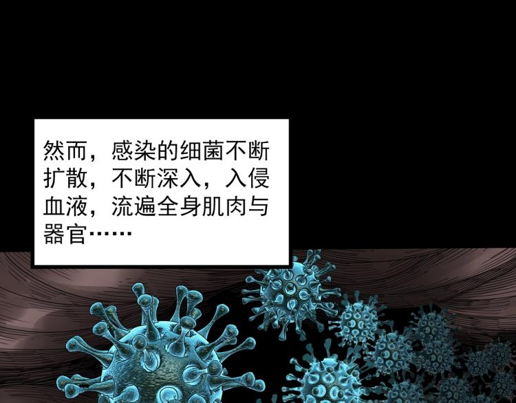 第371话 针管女魔（上）94