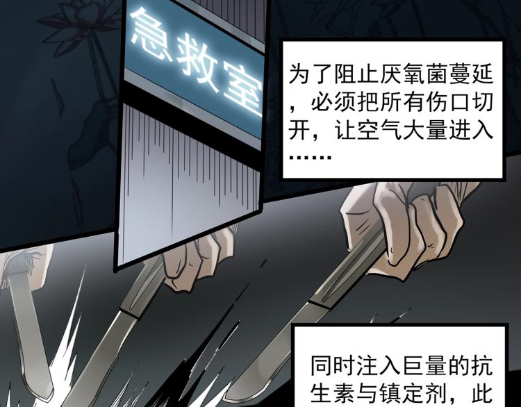 第371话 针管女魔（上）97