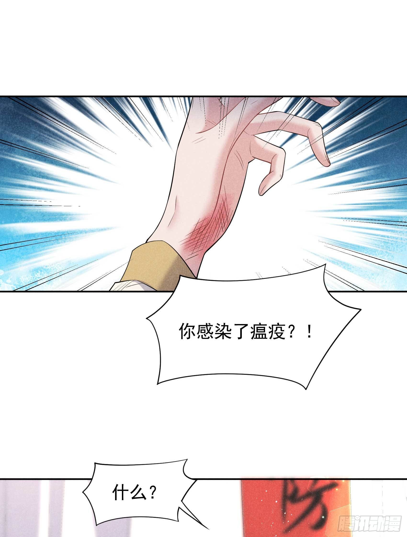 第115话 锡岚被咬！16