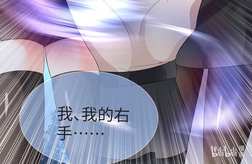 19 第18话 失控的右手77