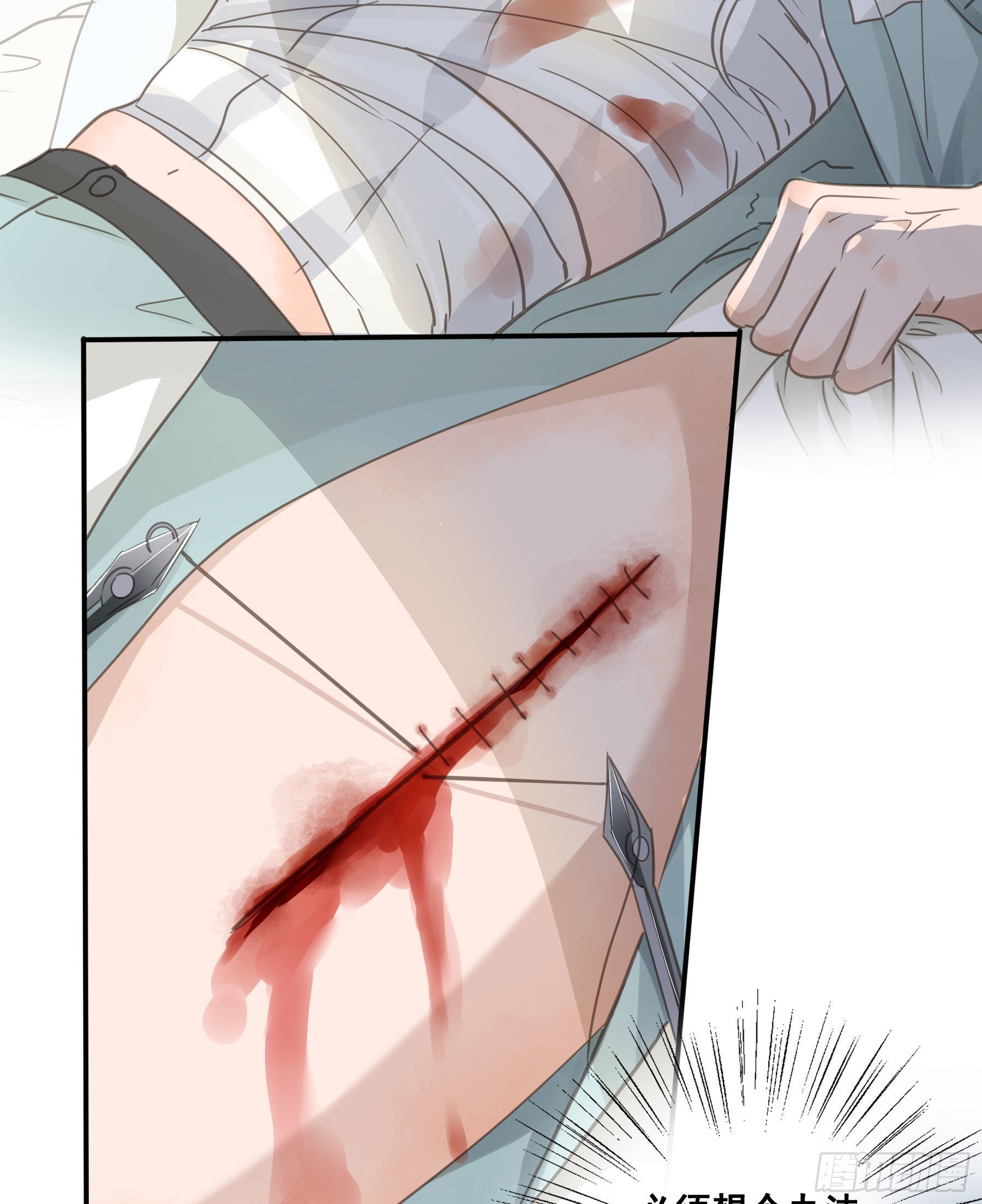 口哨5