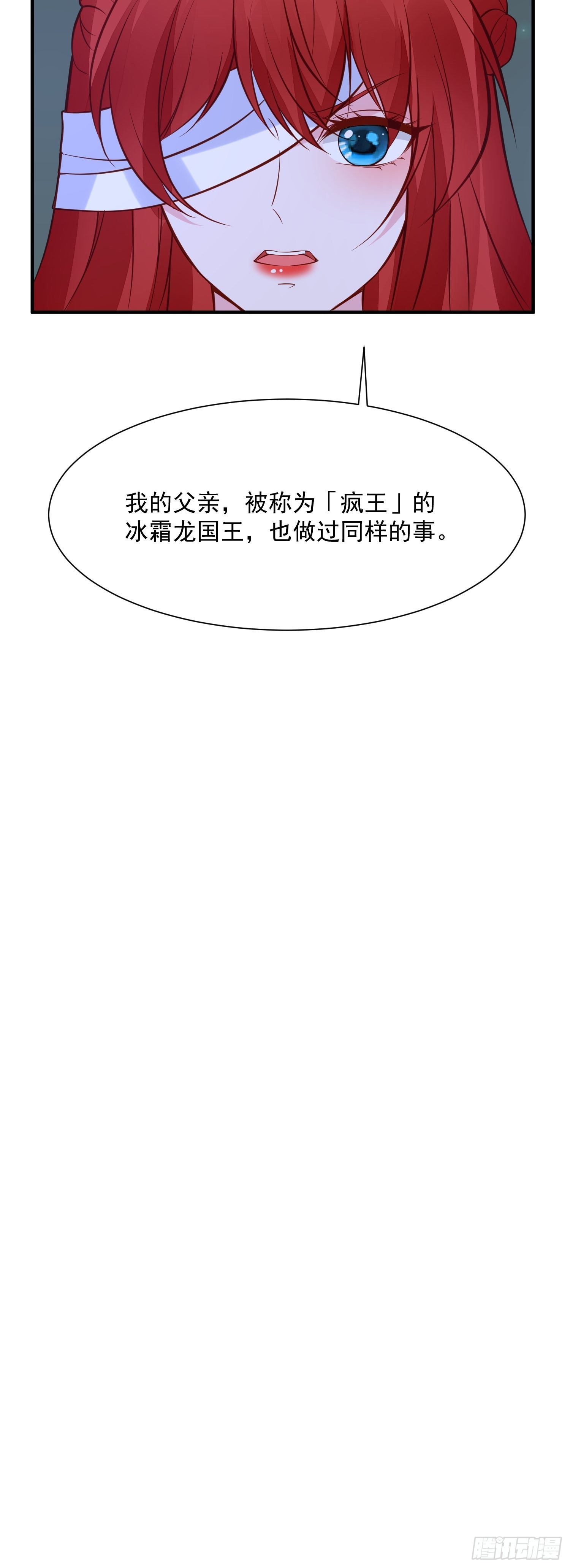 第91话 眼睛的代价17