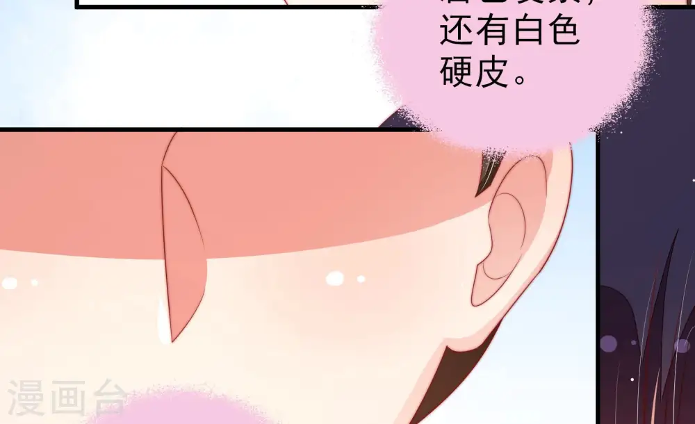 第186话 毒已入骨61
