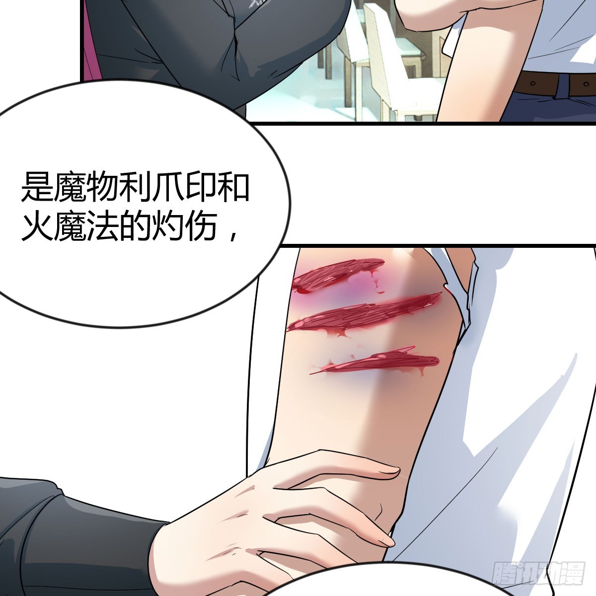 还疼吗4