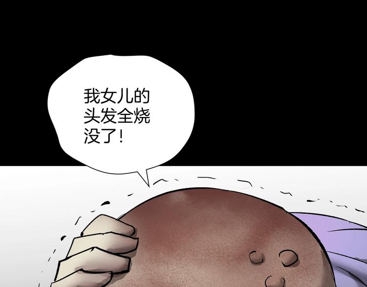 第24话 头发170