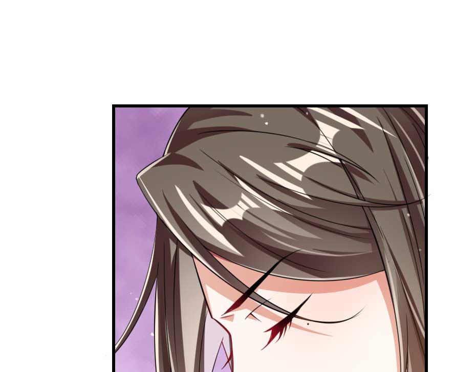 第63话 敢伤你的都该死34