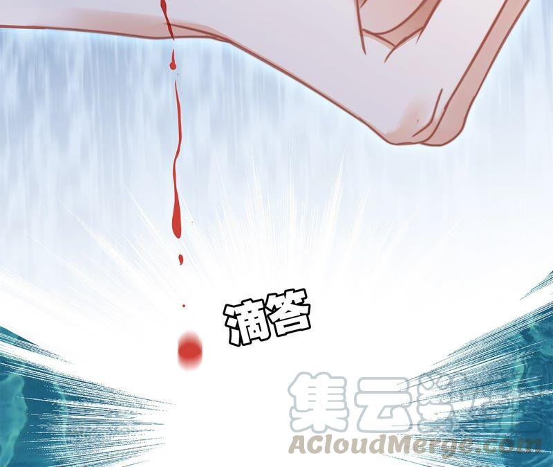 第93话 侵蚀3