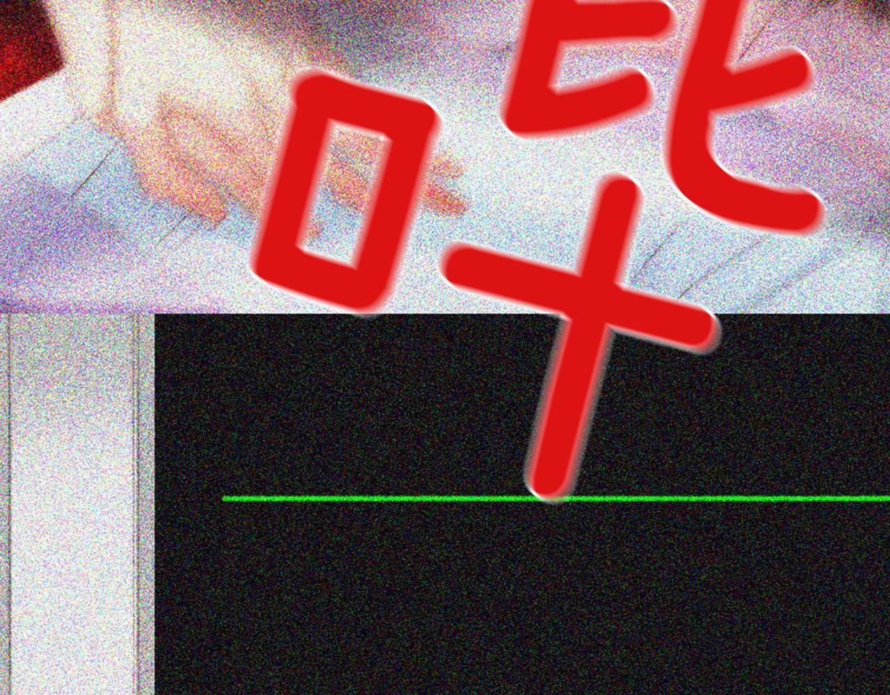 第2季 第17话 移植手术262