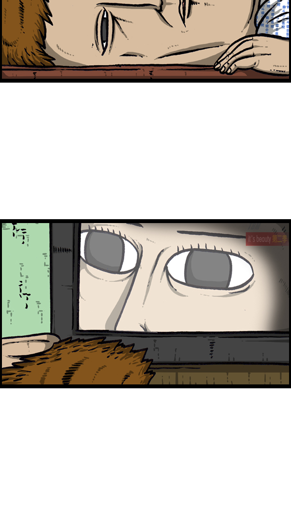 [第300话] 大肠内视镜检查24