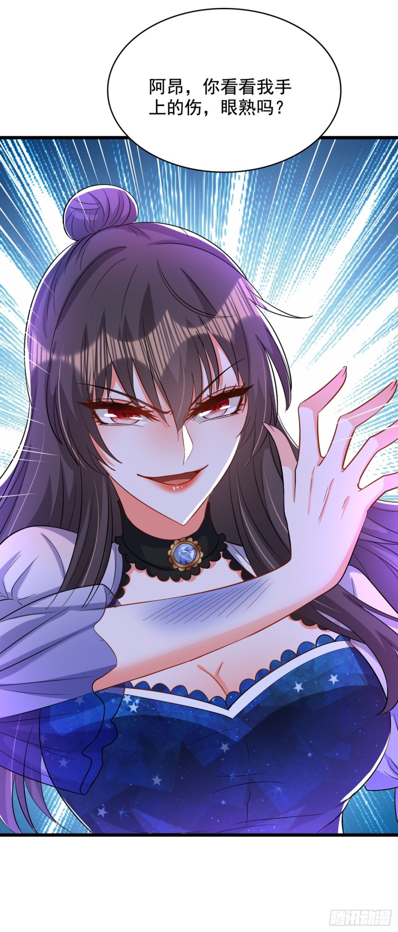 第205话 你手上的伤……40