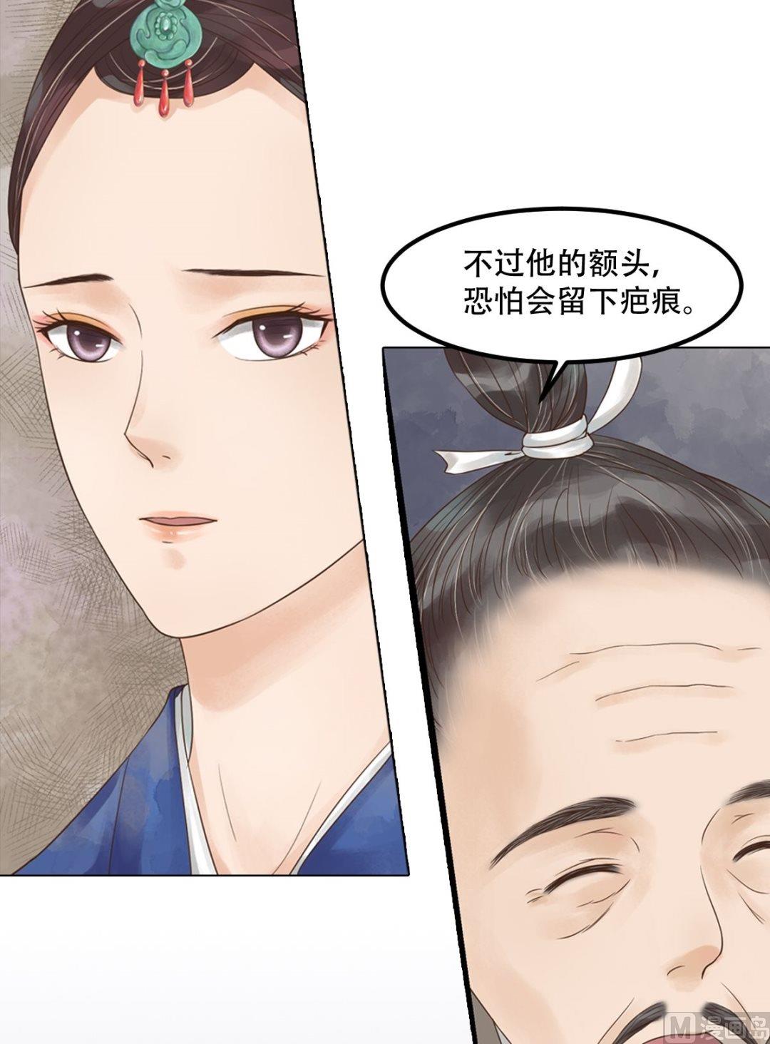 第45话敏德破相20