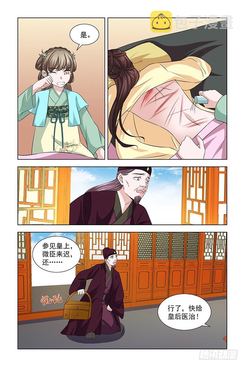 050 快给皇后医治2