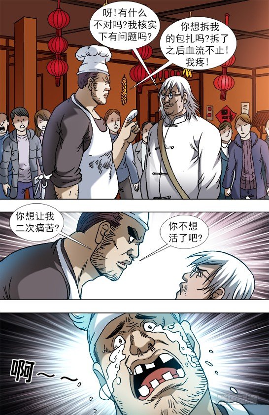 851 断手指7