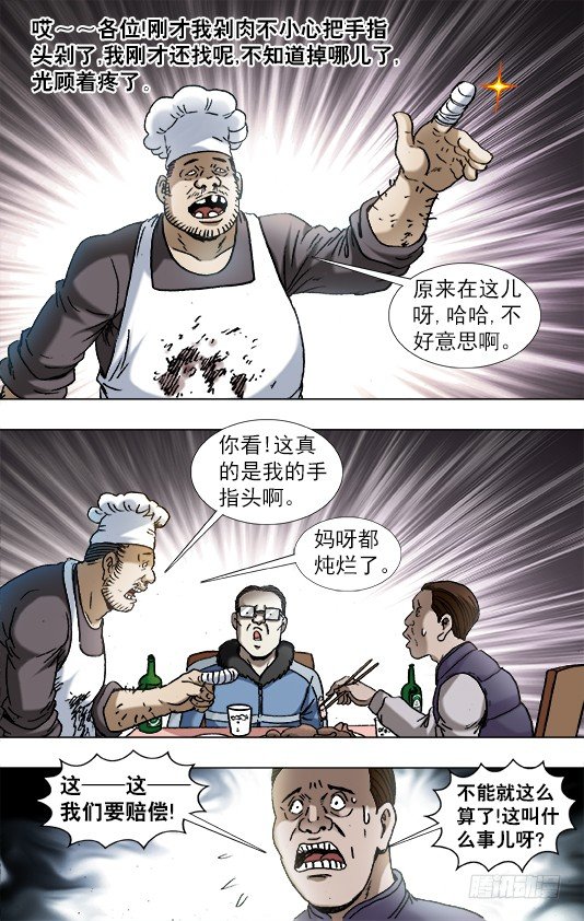 851 断手指4