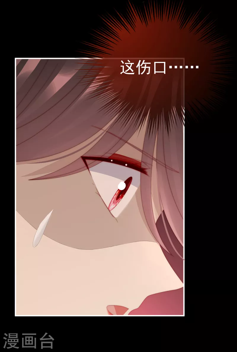 第63话 小猪仔要死了？！22