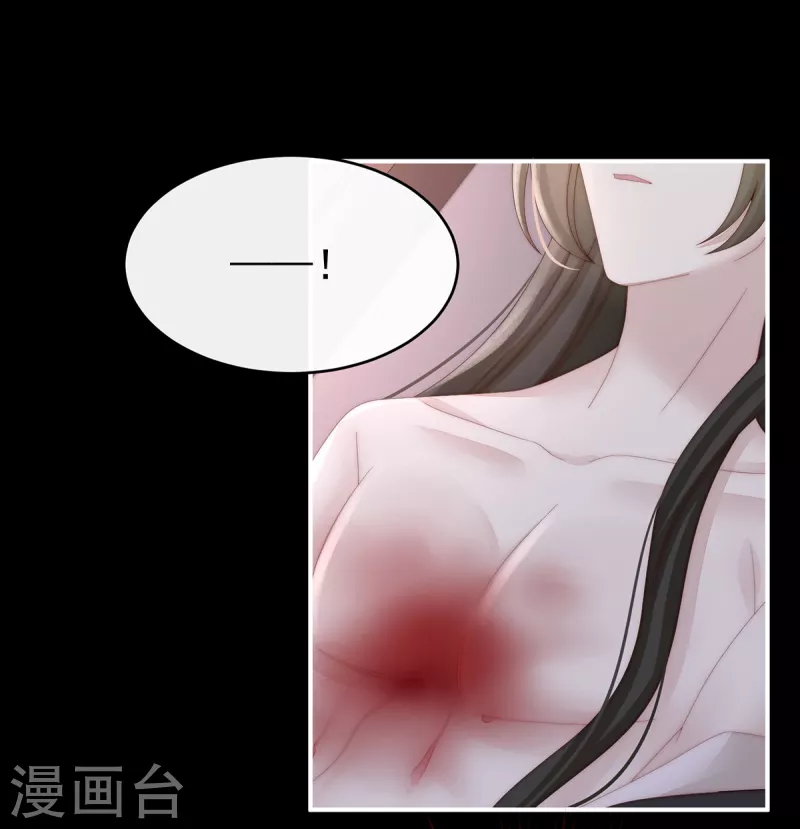 第63话 小猪仔要死了？！21