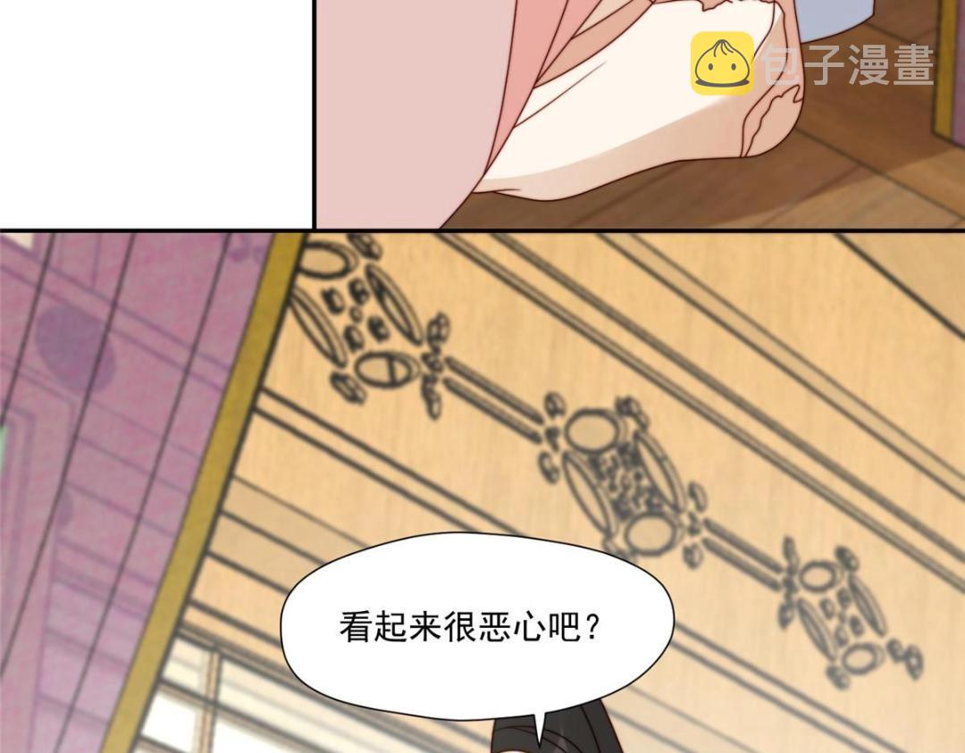 26 伤口84