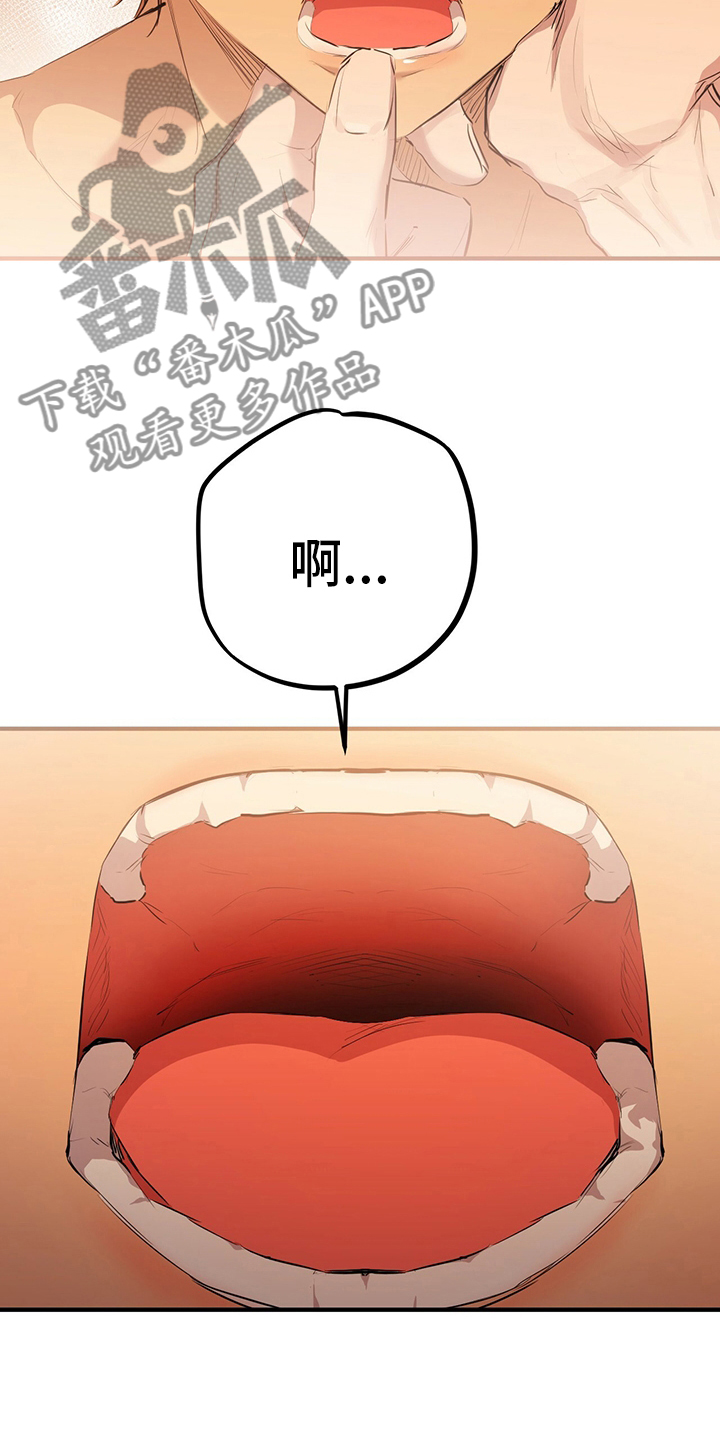 第76章：完蛋了17