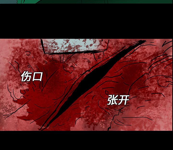 第15章：再次手术44