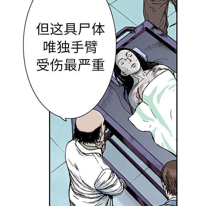 第23章：尸检的可疑之处21